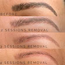 Démaquillage permanent